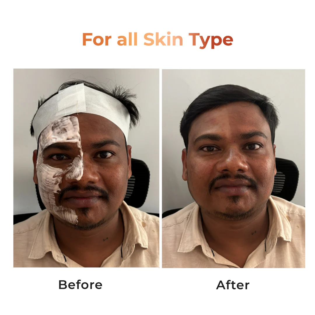 Niconi Tan Vanish Gluta-Kojic Skin Polish - B2B - Image 3