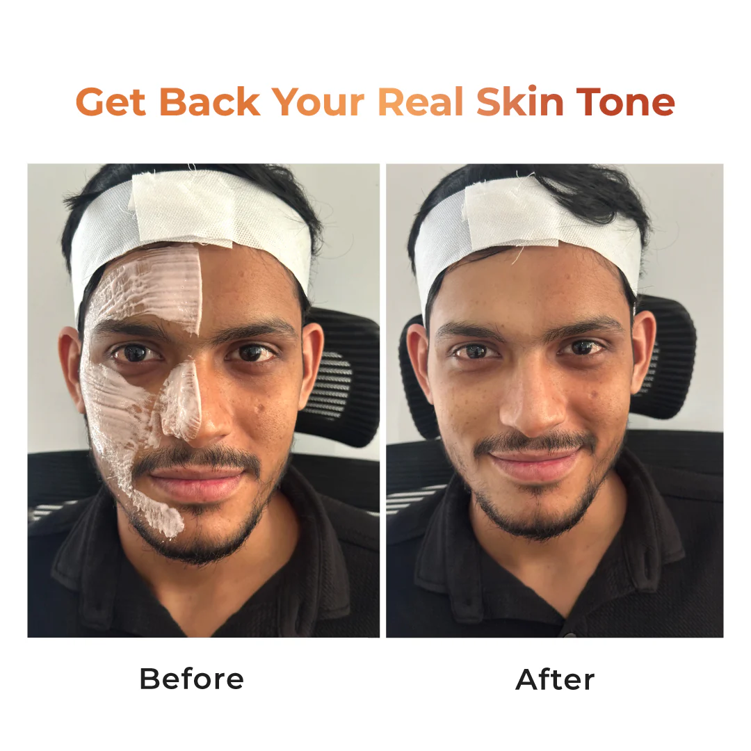 Niconi Tan Vanish Gluta-Kojic Skin Polish - B2B - Image 5